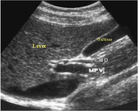 echografie